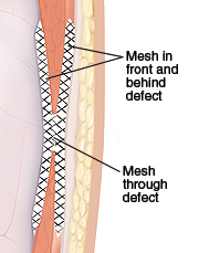 combination repair